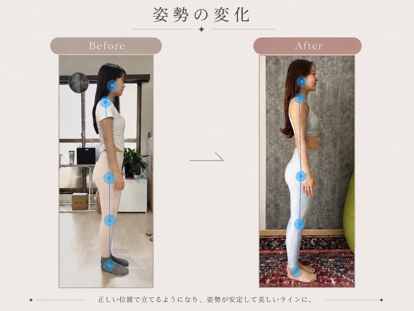 姿勢の変化（横向き）｜ピラティス前後の立ち姿の比較