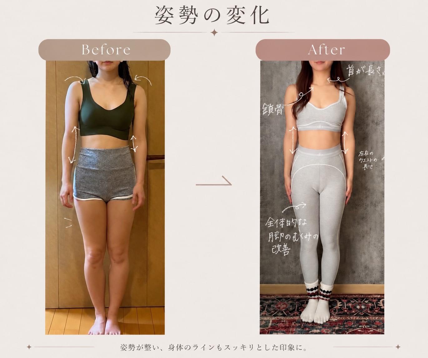 姿勢の変化（正面）｜ピラティス前後の身体のラインの比較